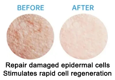 nine peptides powder Repairs Skin nine peptides powder Repairs Skin